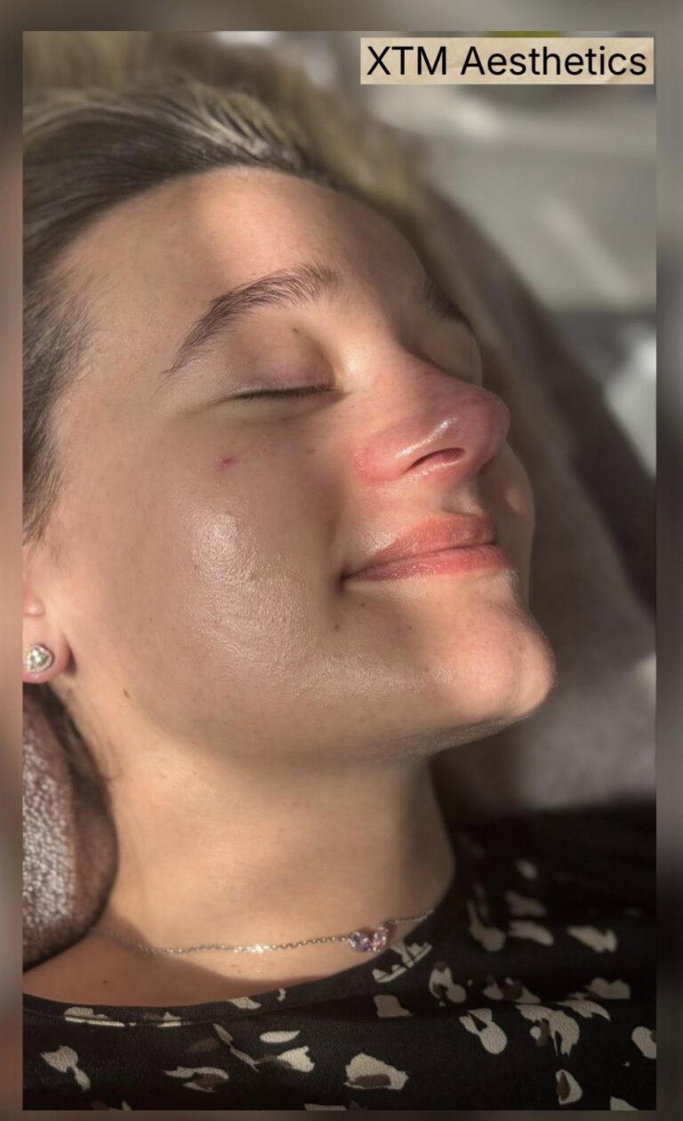 facial result