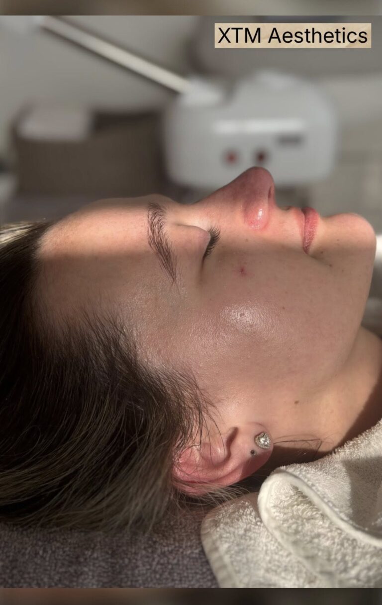 side facial